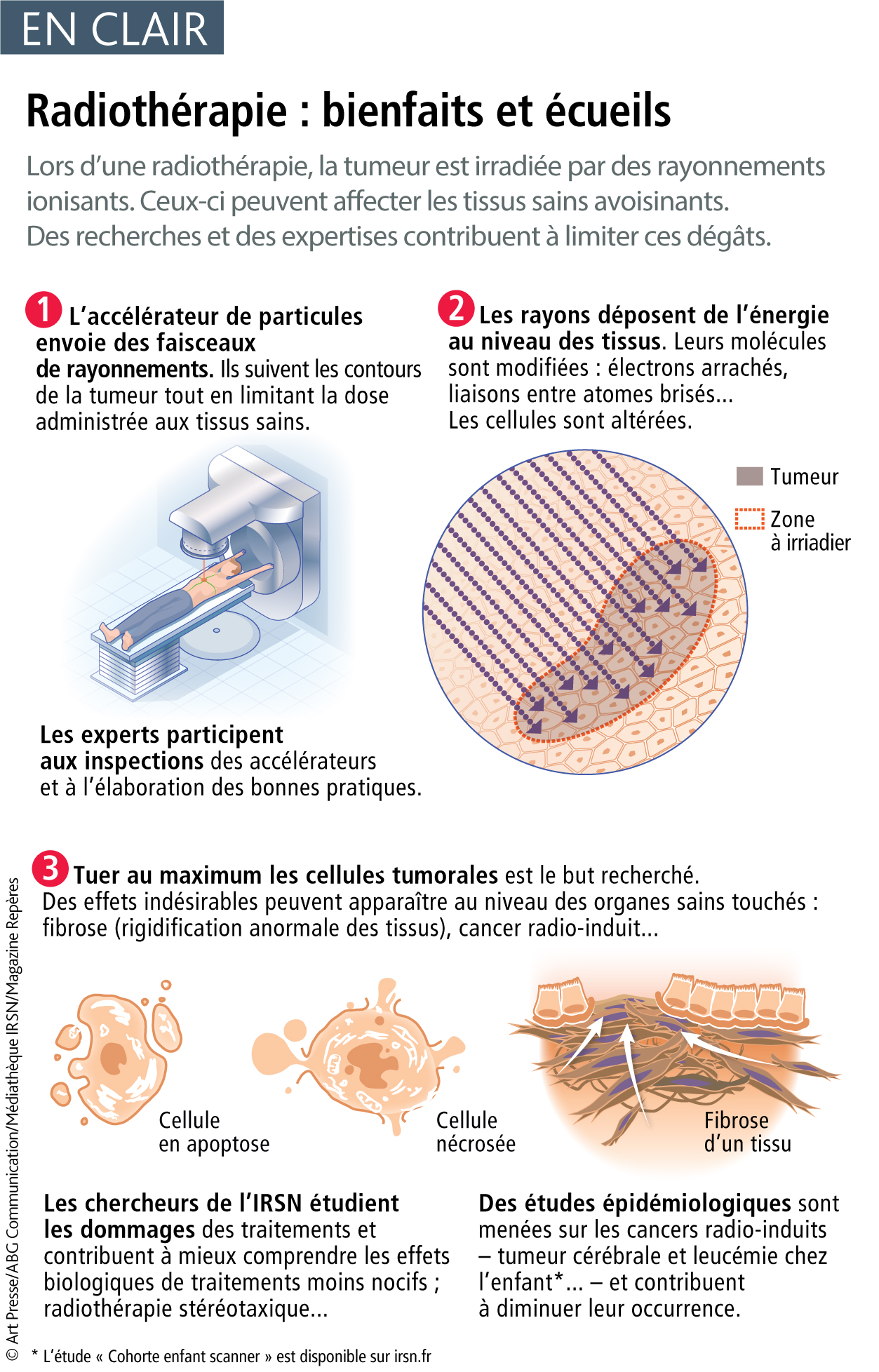 Radioth rapie Pr venir Les Risques Rep res