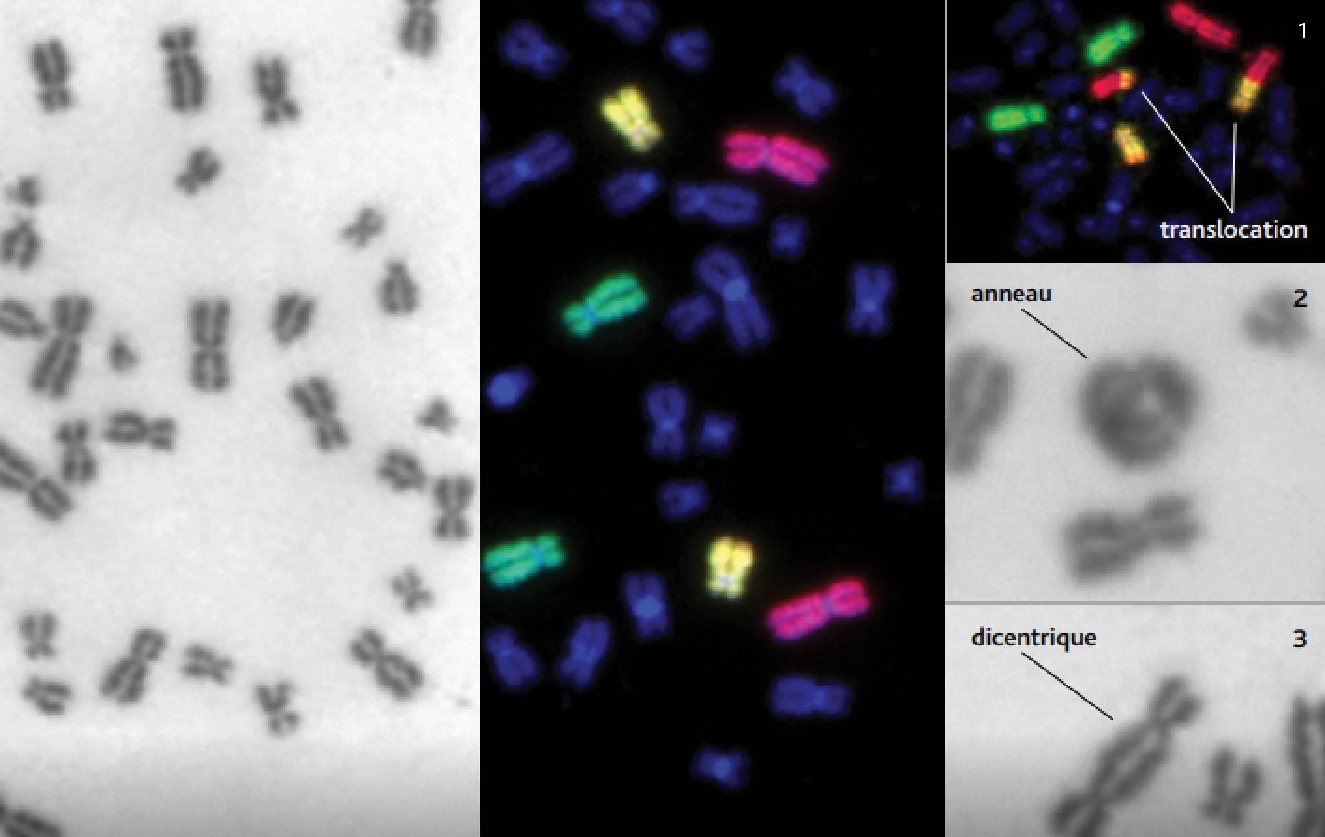 R50-Radiobiologie : l’intelligence artificielle en cas d’urgence 