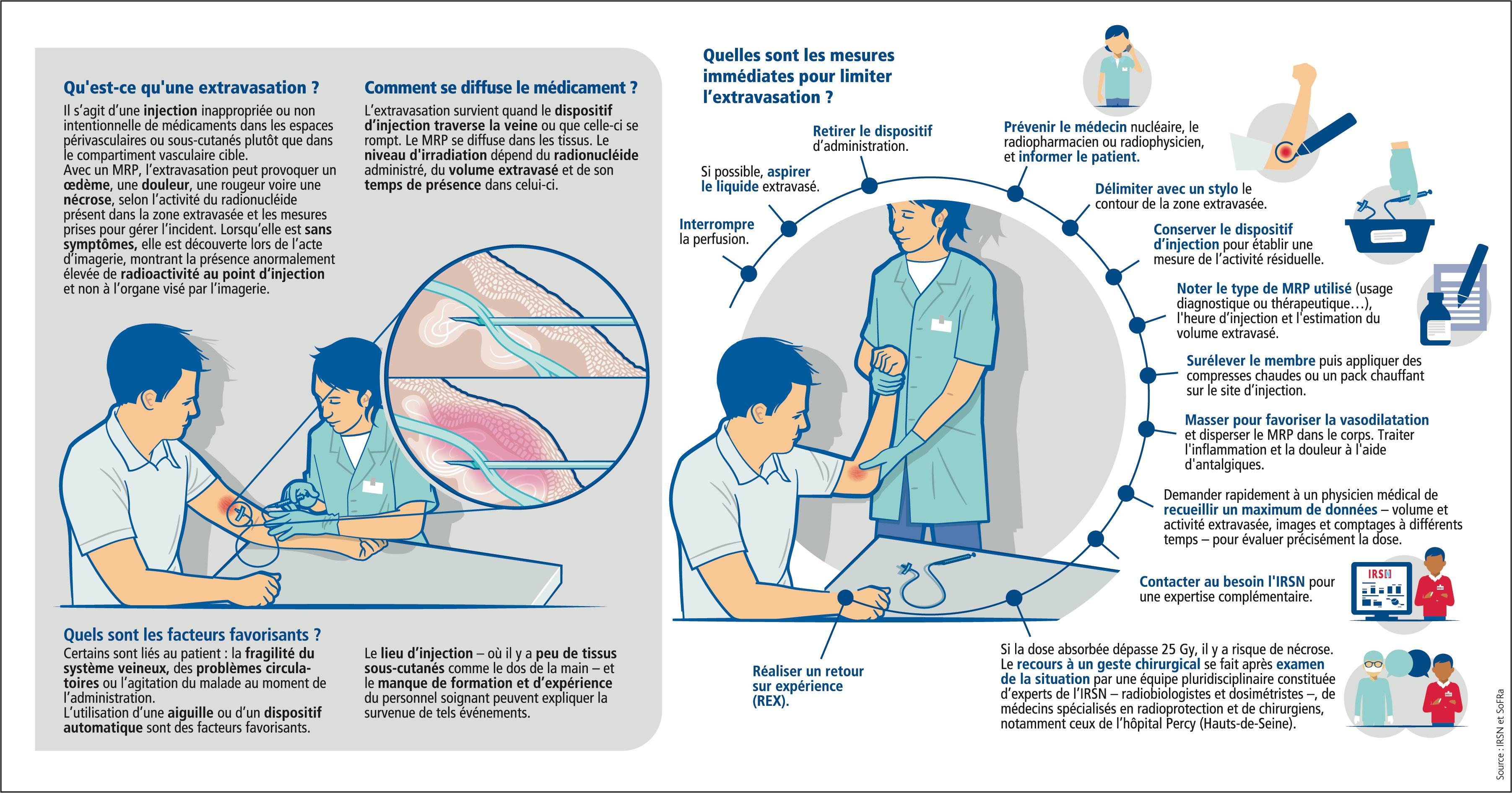 Infographie extravasation